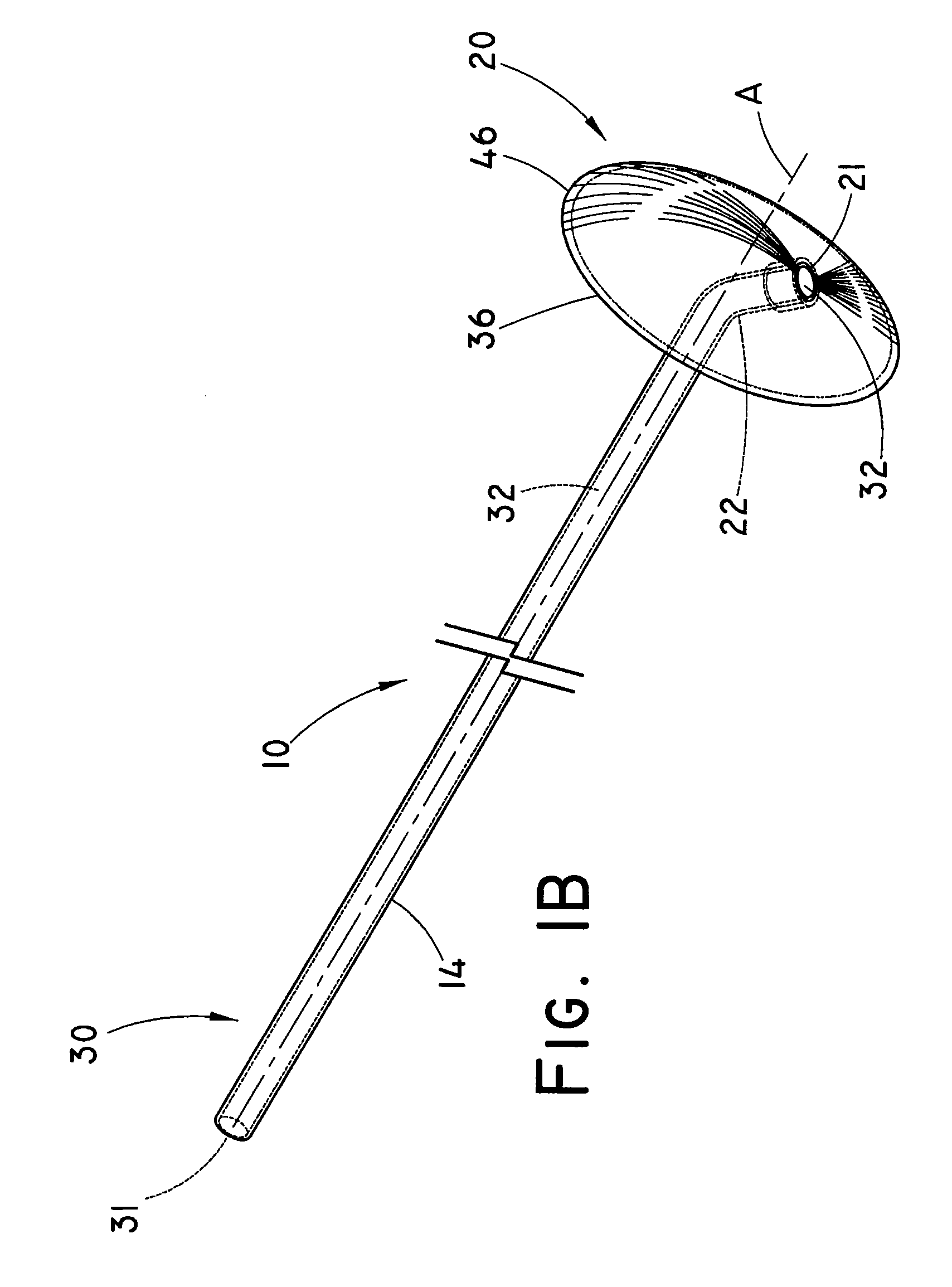 Prophylactic Pancreatic Stent