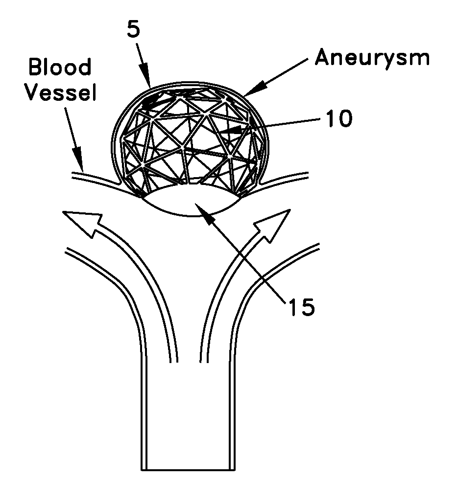 Method and apparatus for restricting flow through an opening in the side wall of a body lumen, and/or for reinforcing a weakness in the side wall of a body lumen, while still maintaining substantially normal flow through the body lumen