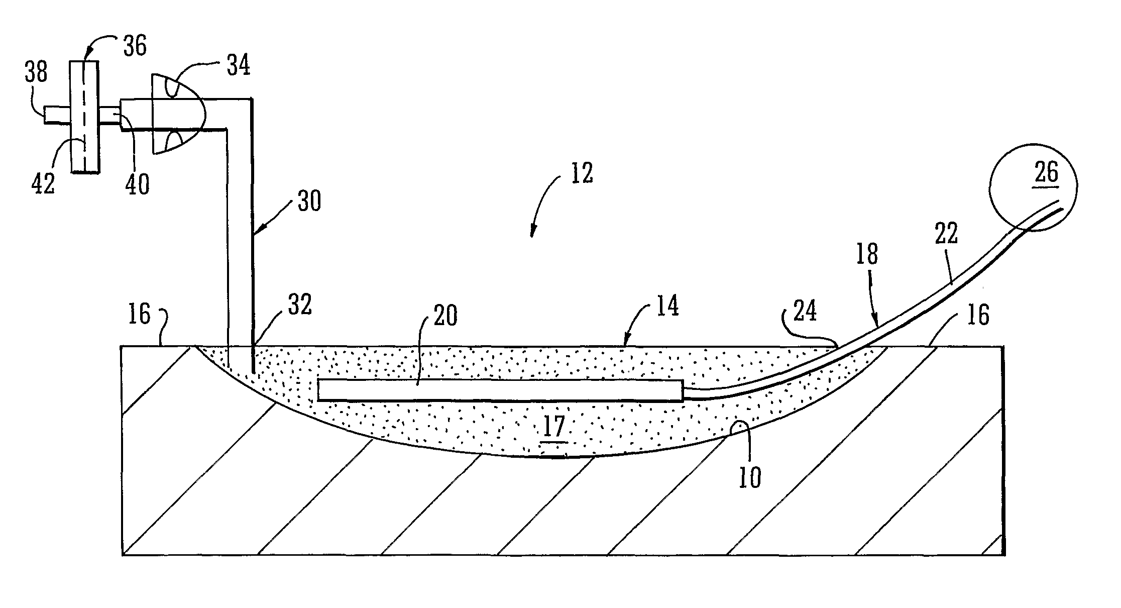 Apparatus for topical negative pressure therapy