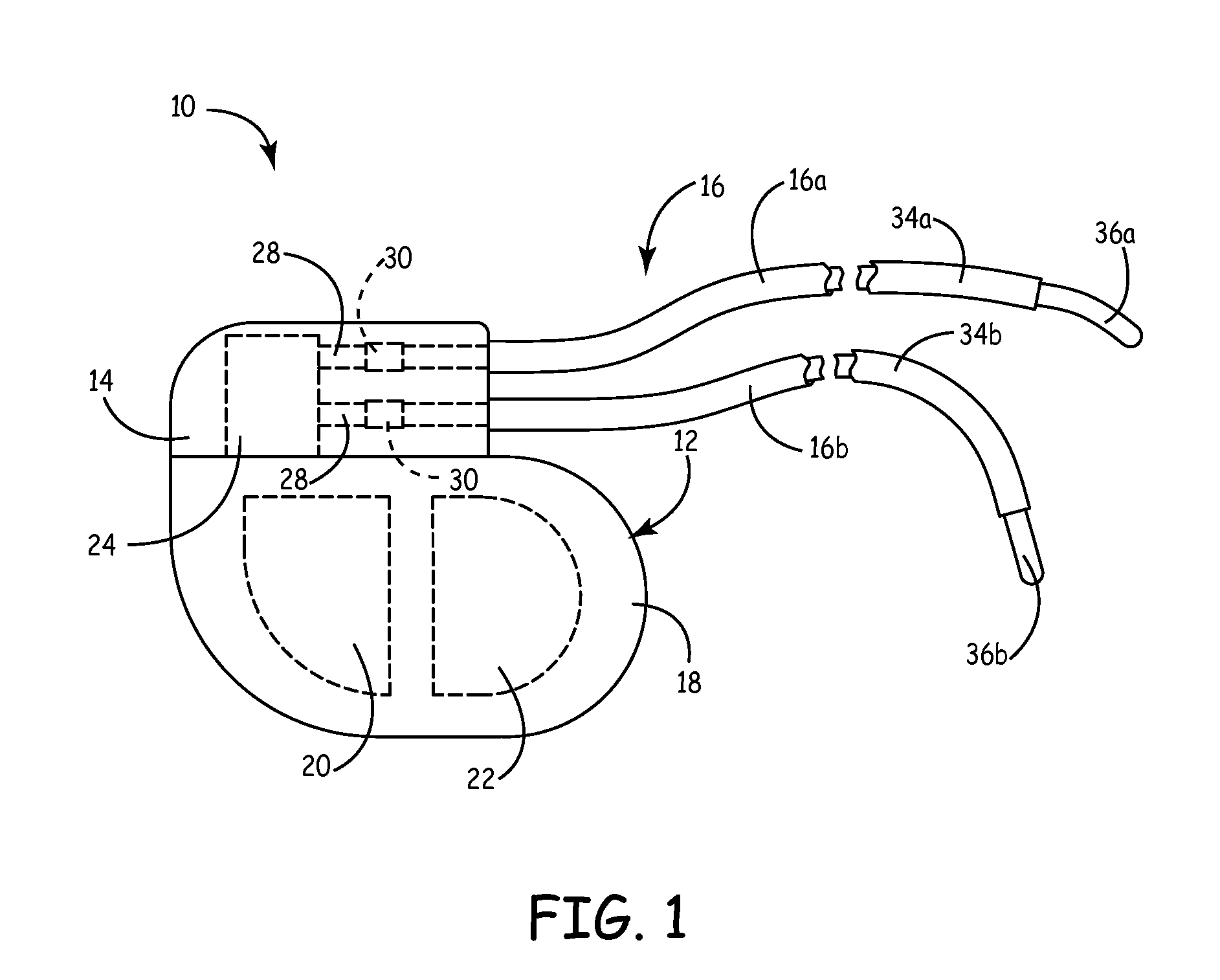 System and method for cardiac lead