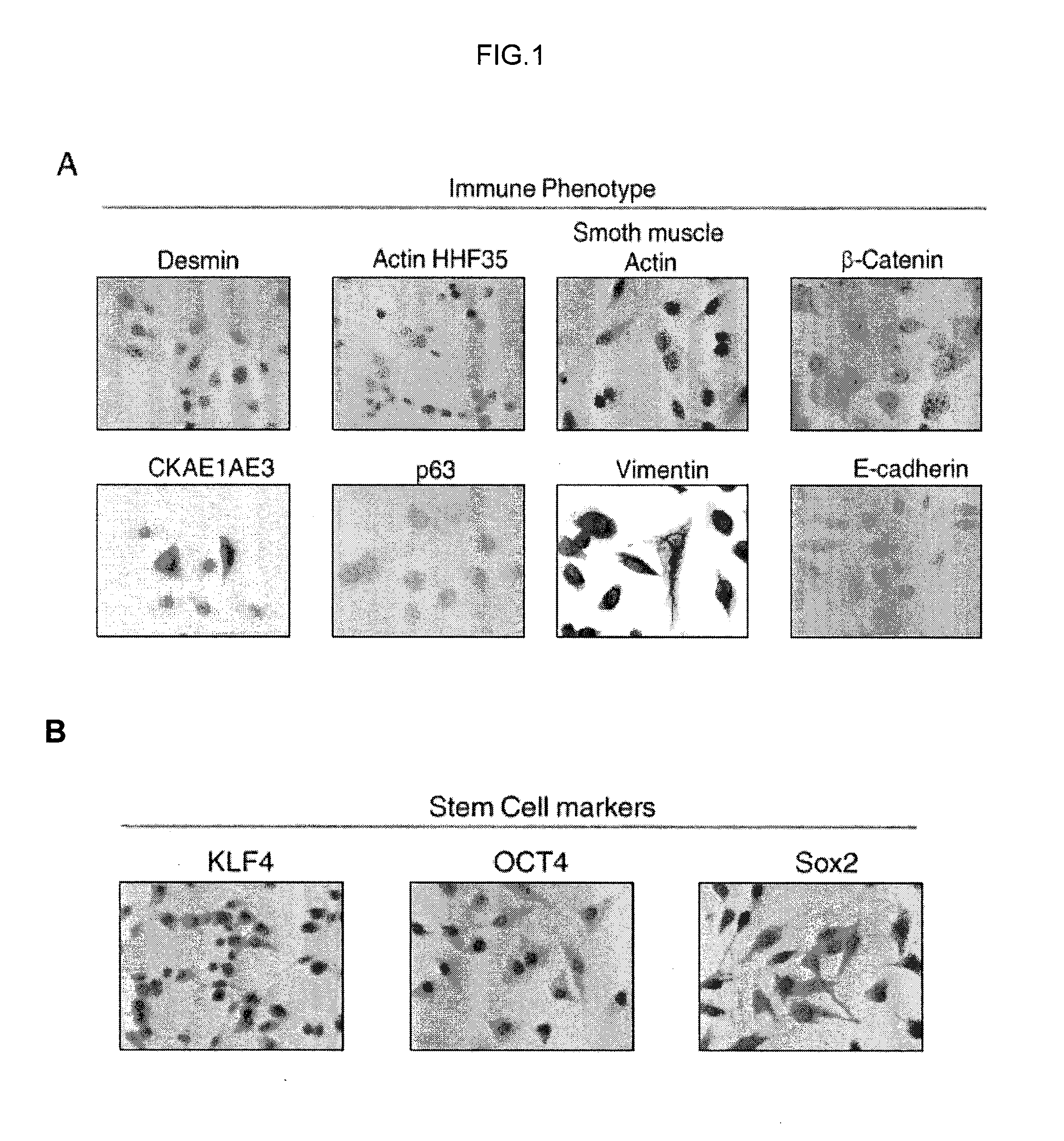 Human uterine cervical stem cell population and uses thereof