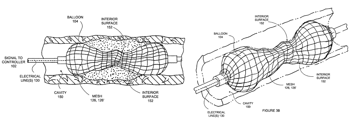 Electrically conductive balloon catheter