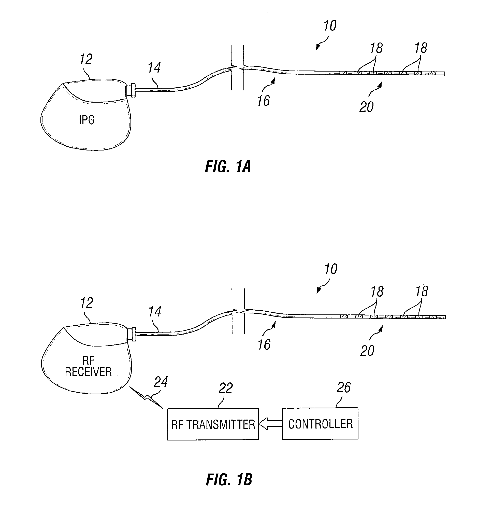 Stimulation design for neuromodulation