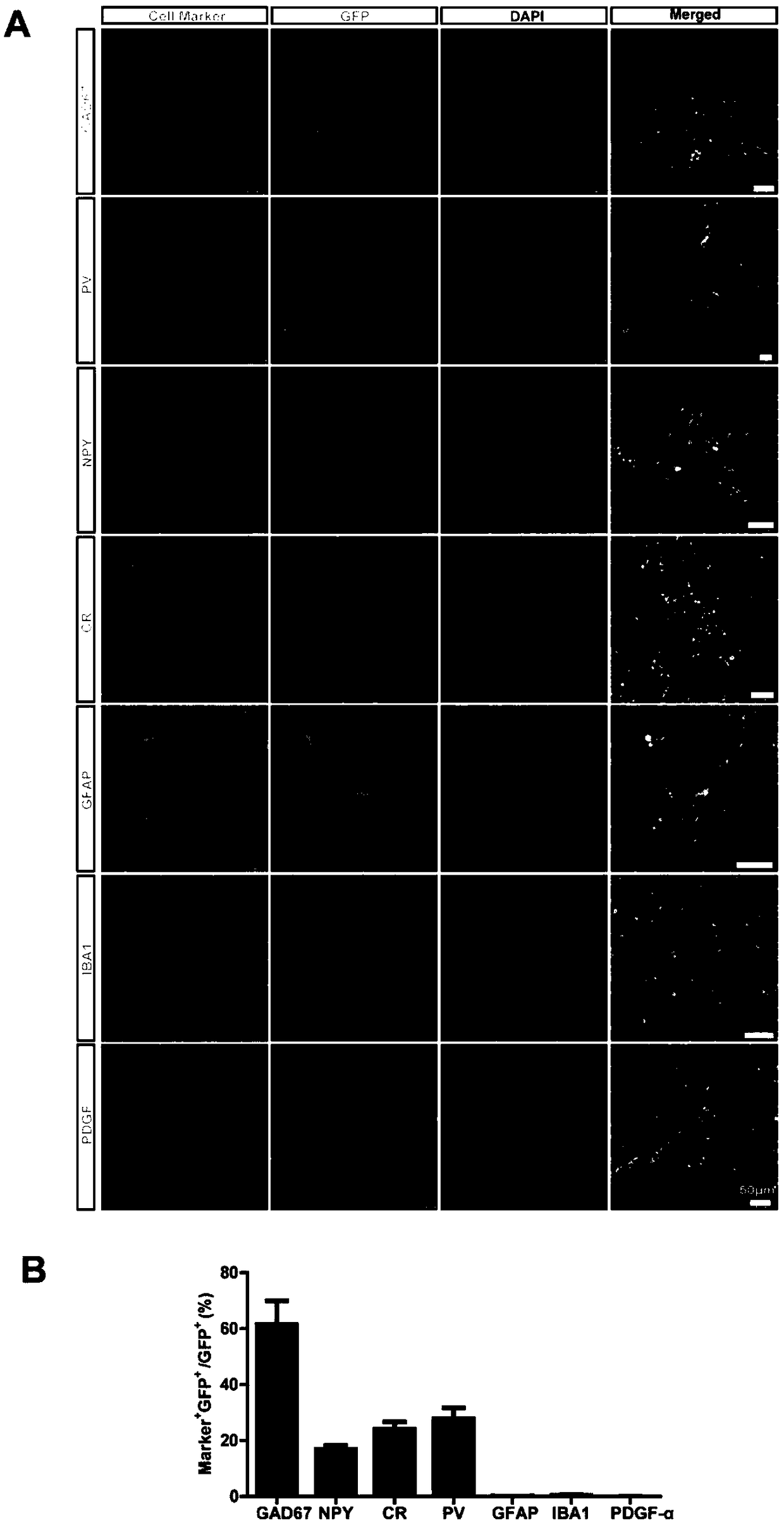 Application of inhibitory neural precursor cell to preparation of drug for treating Alzheimer's disease