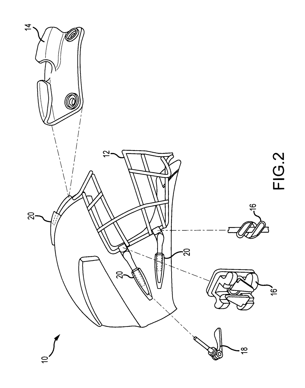 Helmet for reducing concussive forces during collision and facilitating rapid facemask removal