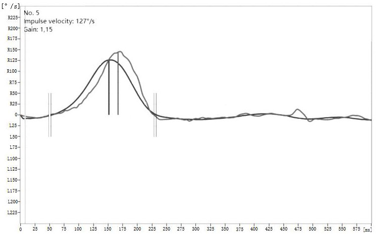 Position time curve drawing method and system and head pulse test evaluation method and system