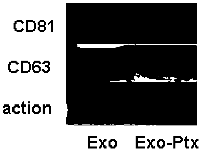 Exosome drug carrying system and applications thereof in spinal cord injury repairing