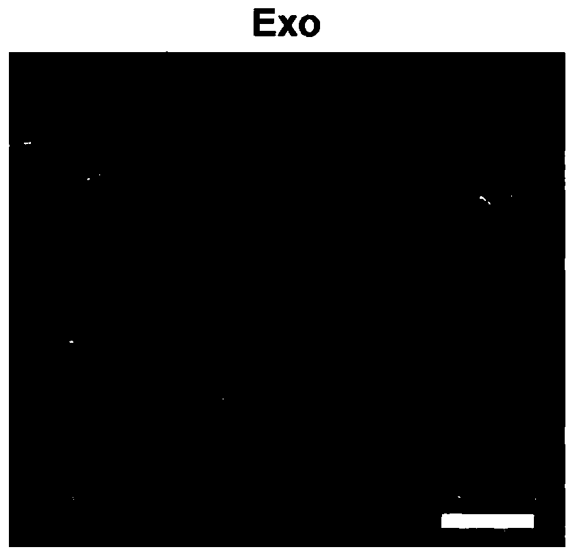 Exosome drug carrying system and applications thereof in spinal cord injury repairing