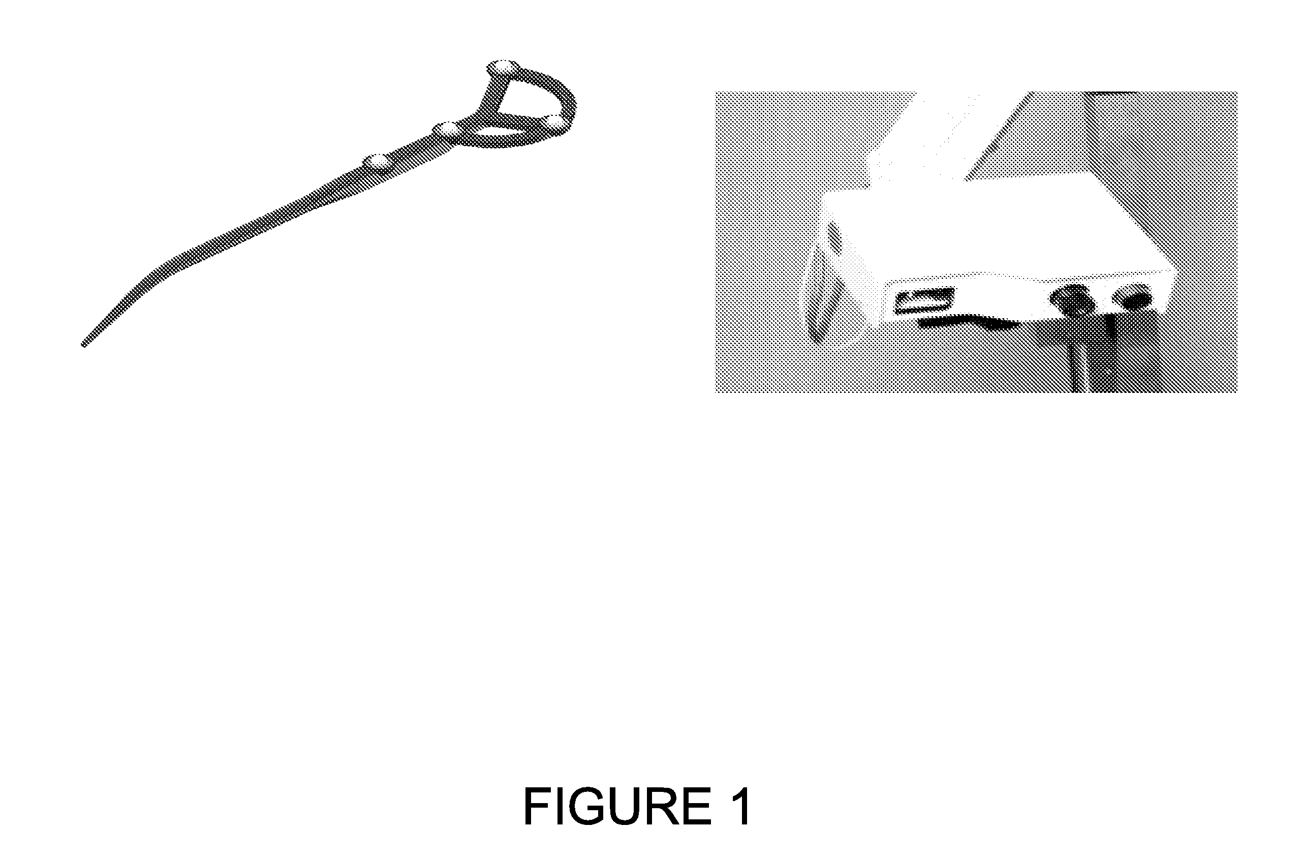 System and method for abdominal surface matching using pseudo-features