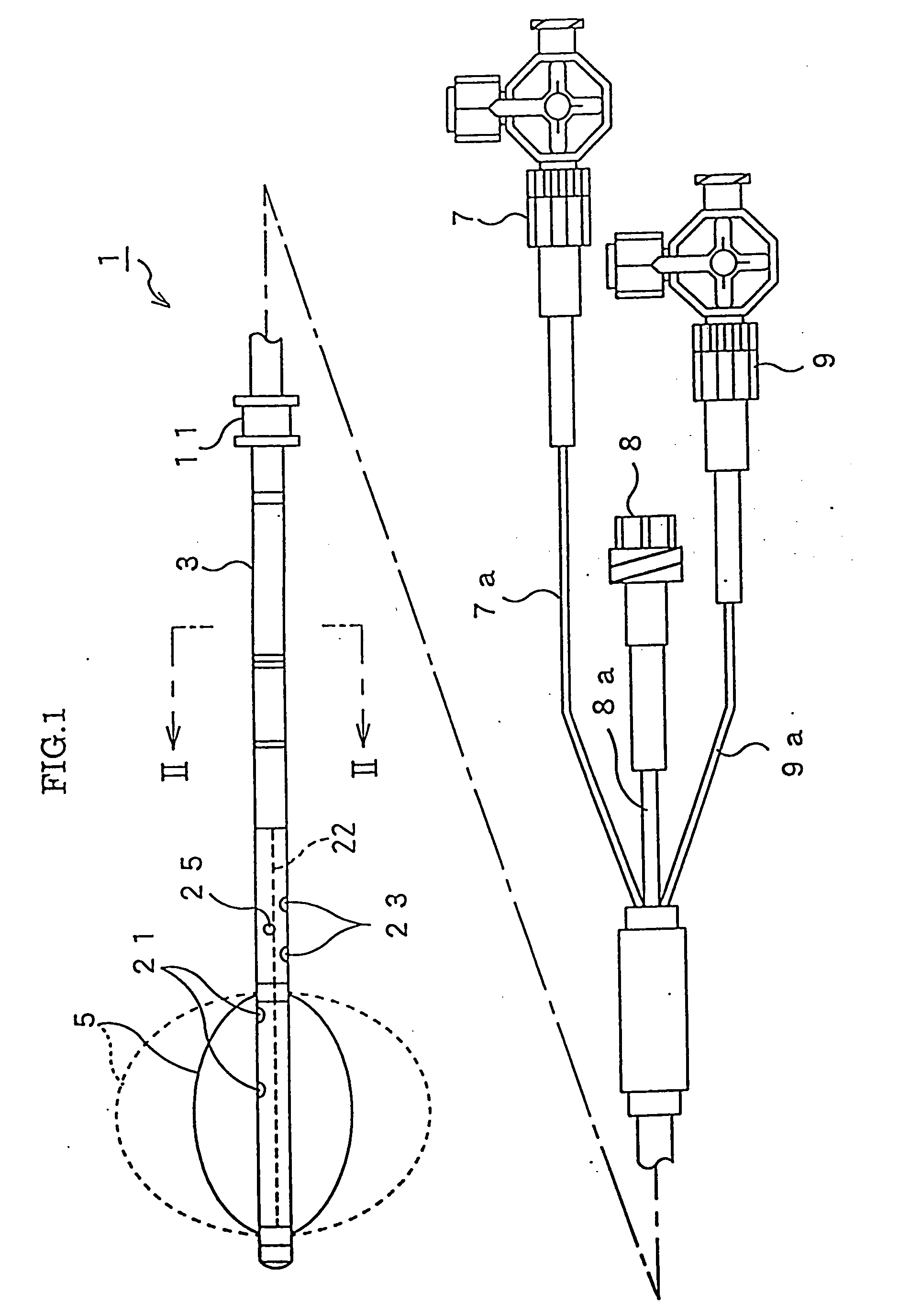 Occlusion catheter for the ascending aorta