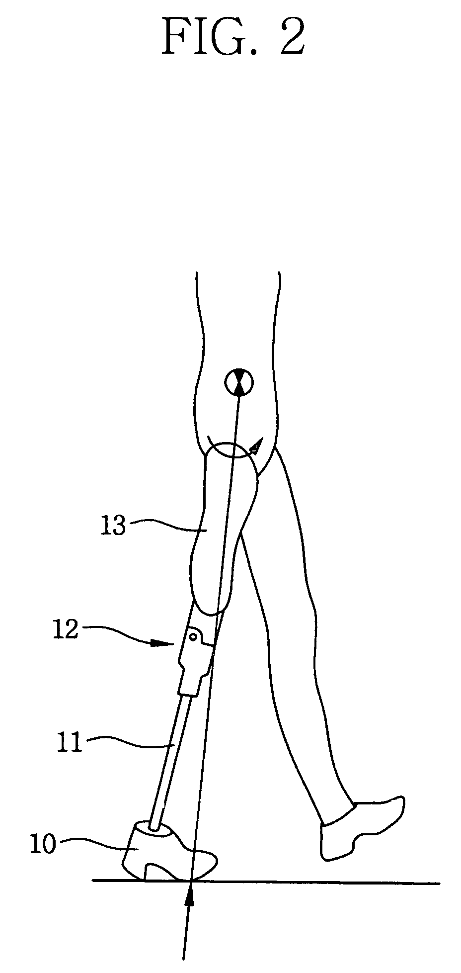 Implant device for osseointegration to endure weight