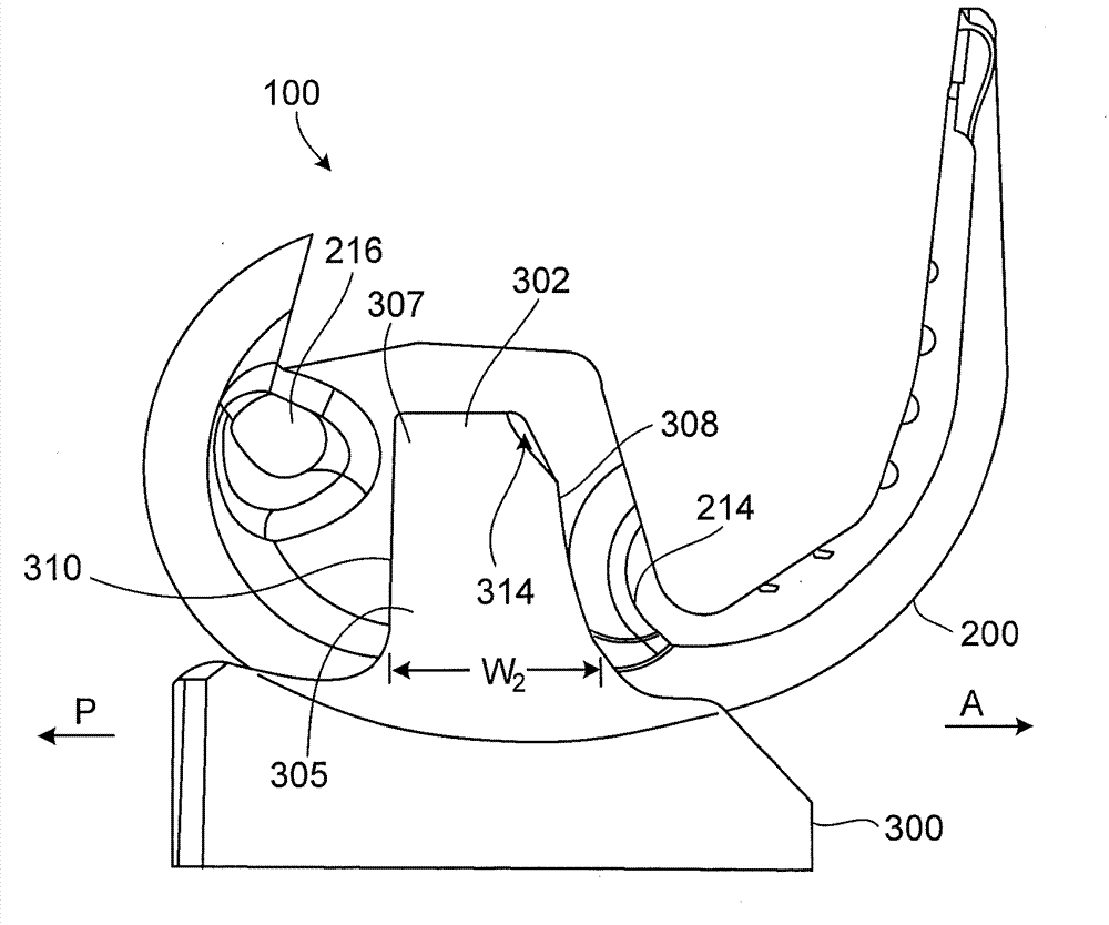 Constrained knee prosthesis