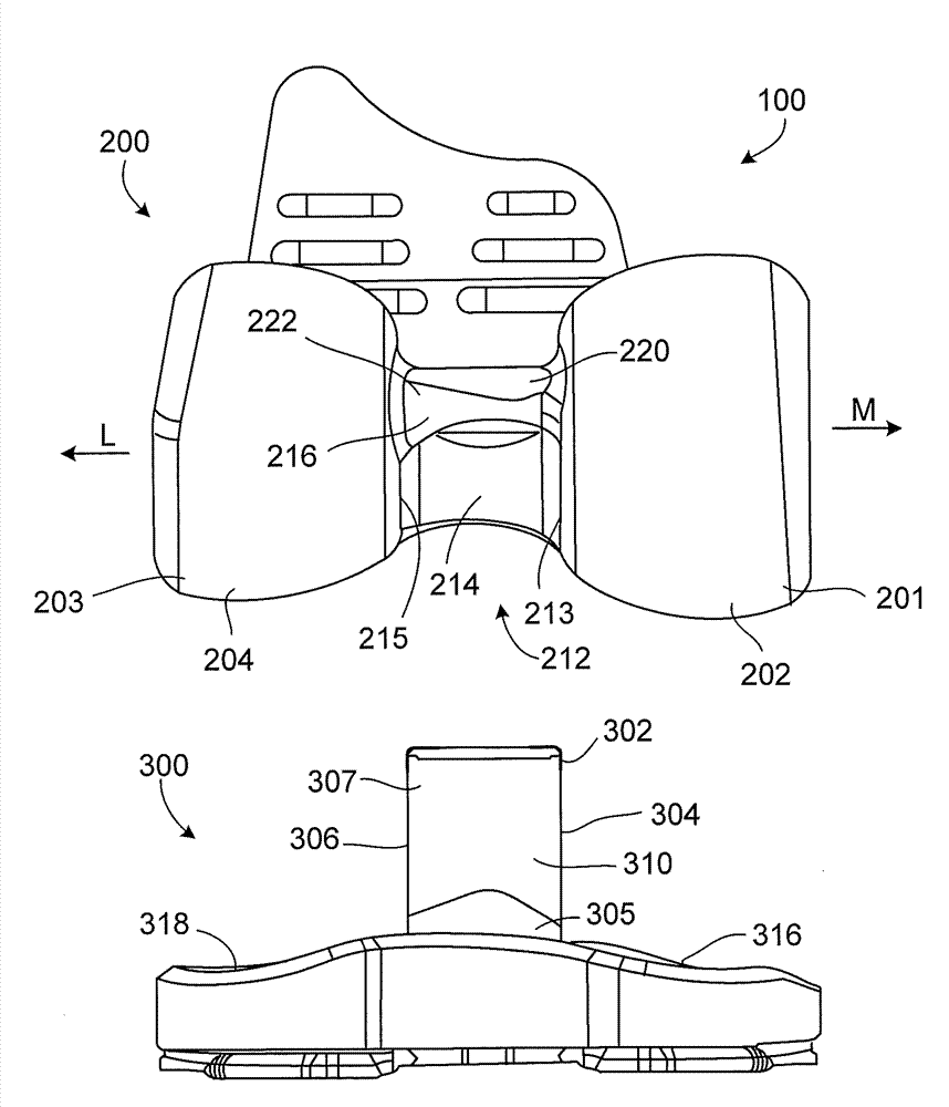 Constrained knee prosthesis