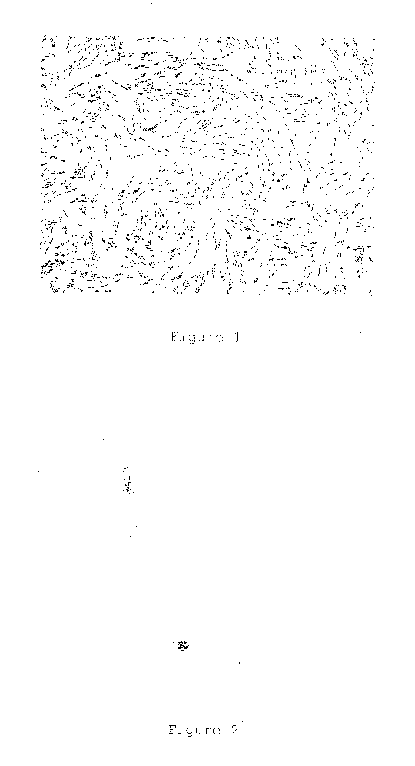 Differentiation process of mesenchymal stem cells and therapeutic use thereof