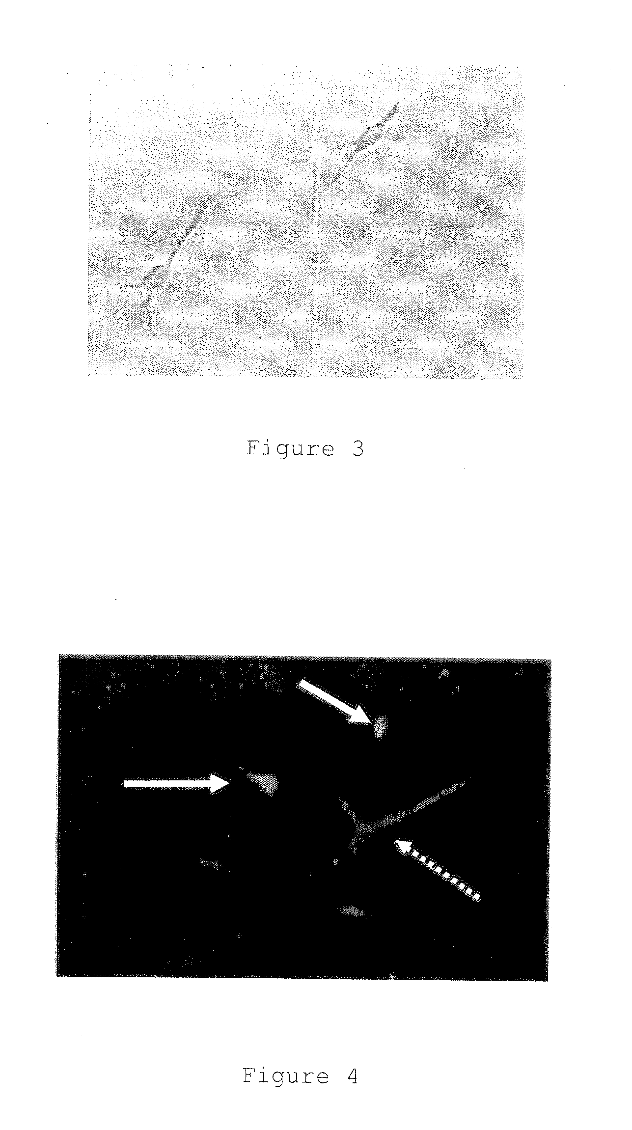 Differentiation process of mesenchymal stem cells and therapeutic use thereof