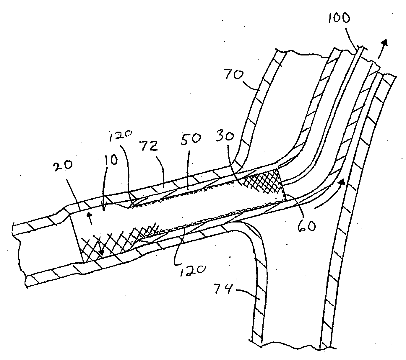 Medical adhesive for medical devices