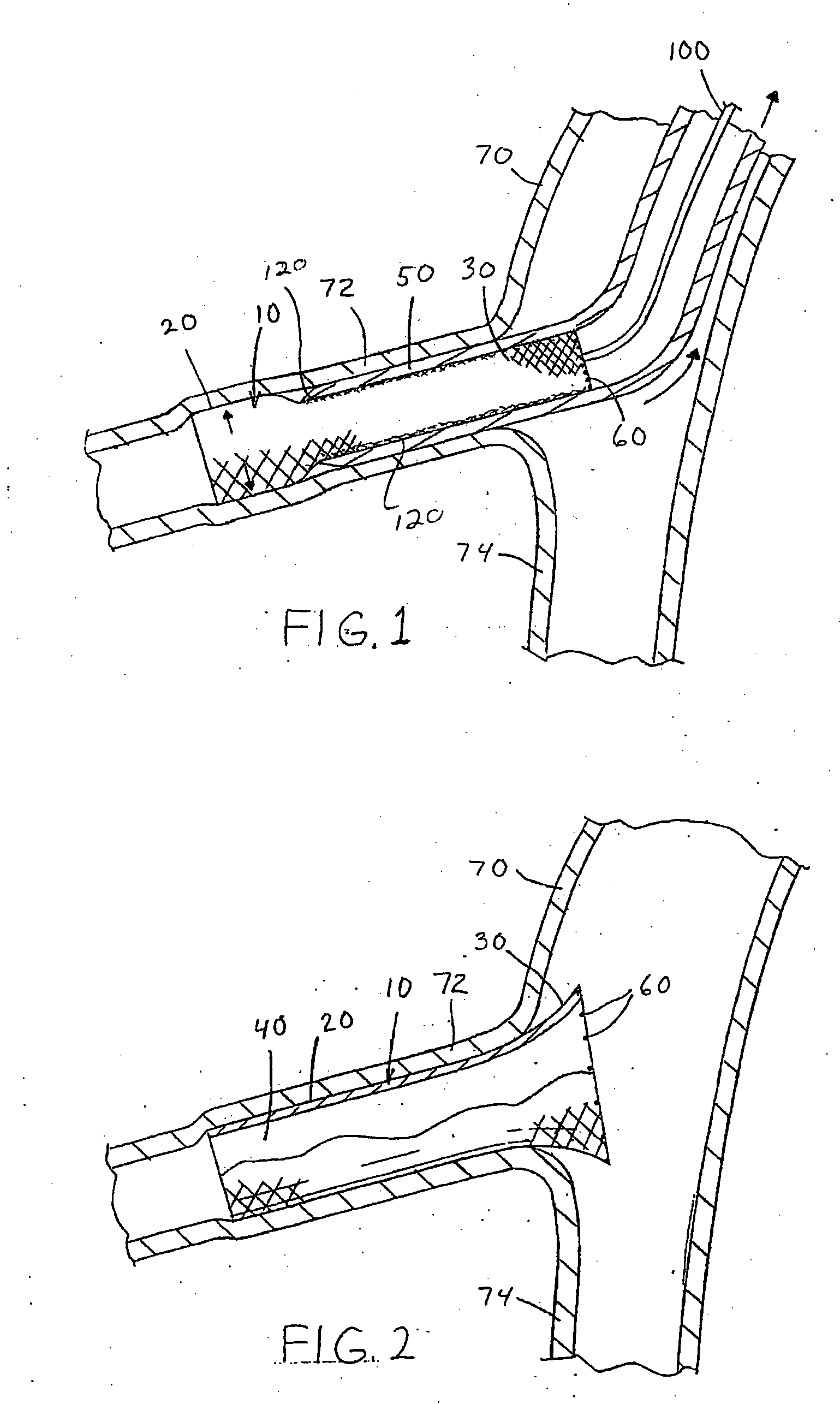 Medical adhesive for medical devices