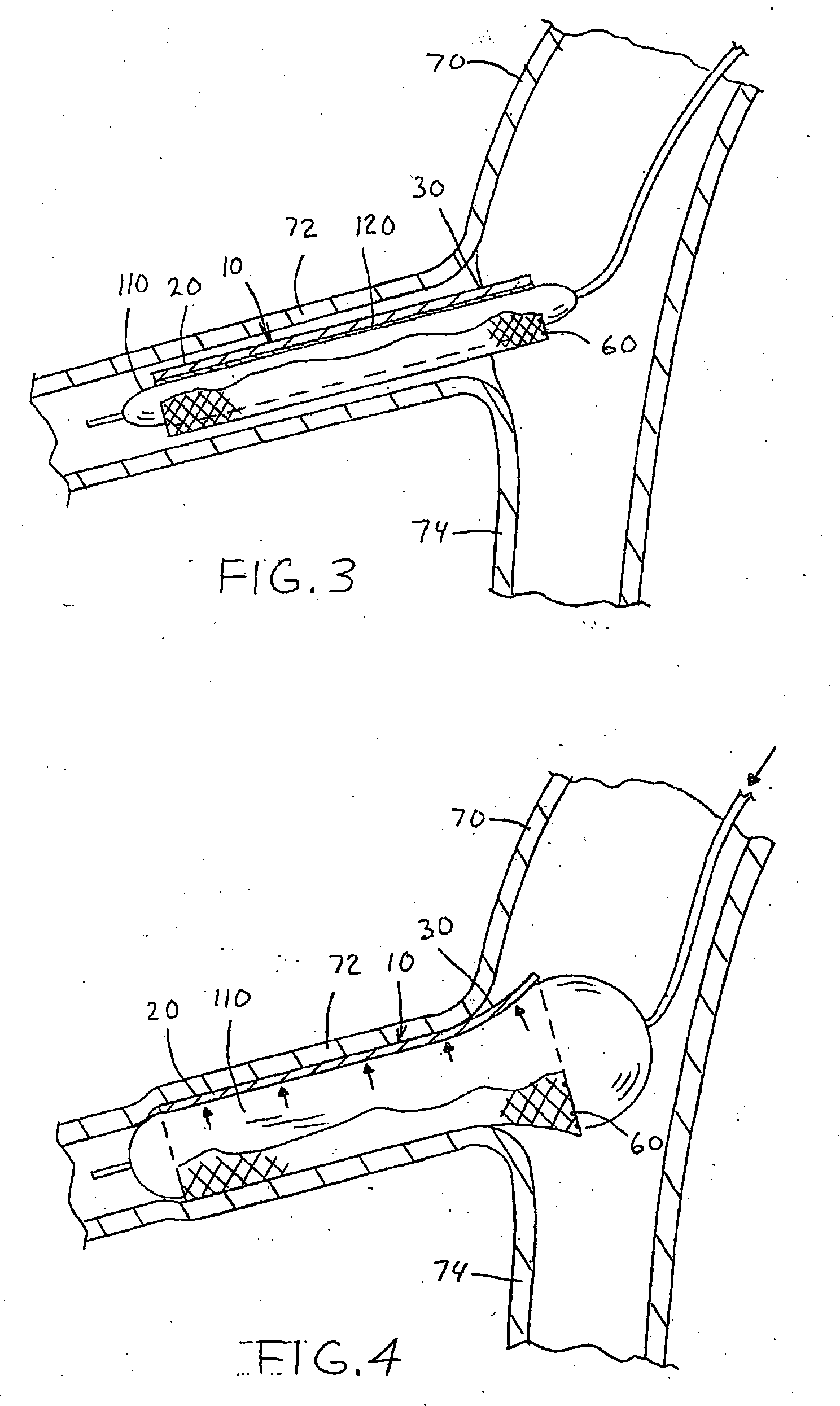 Medical adhesive for medical devices