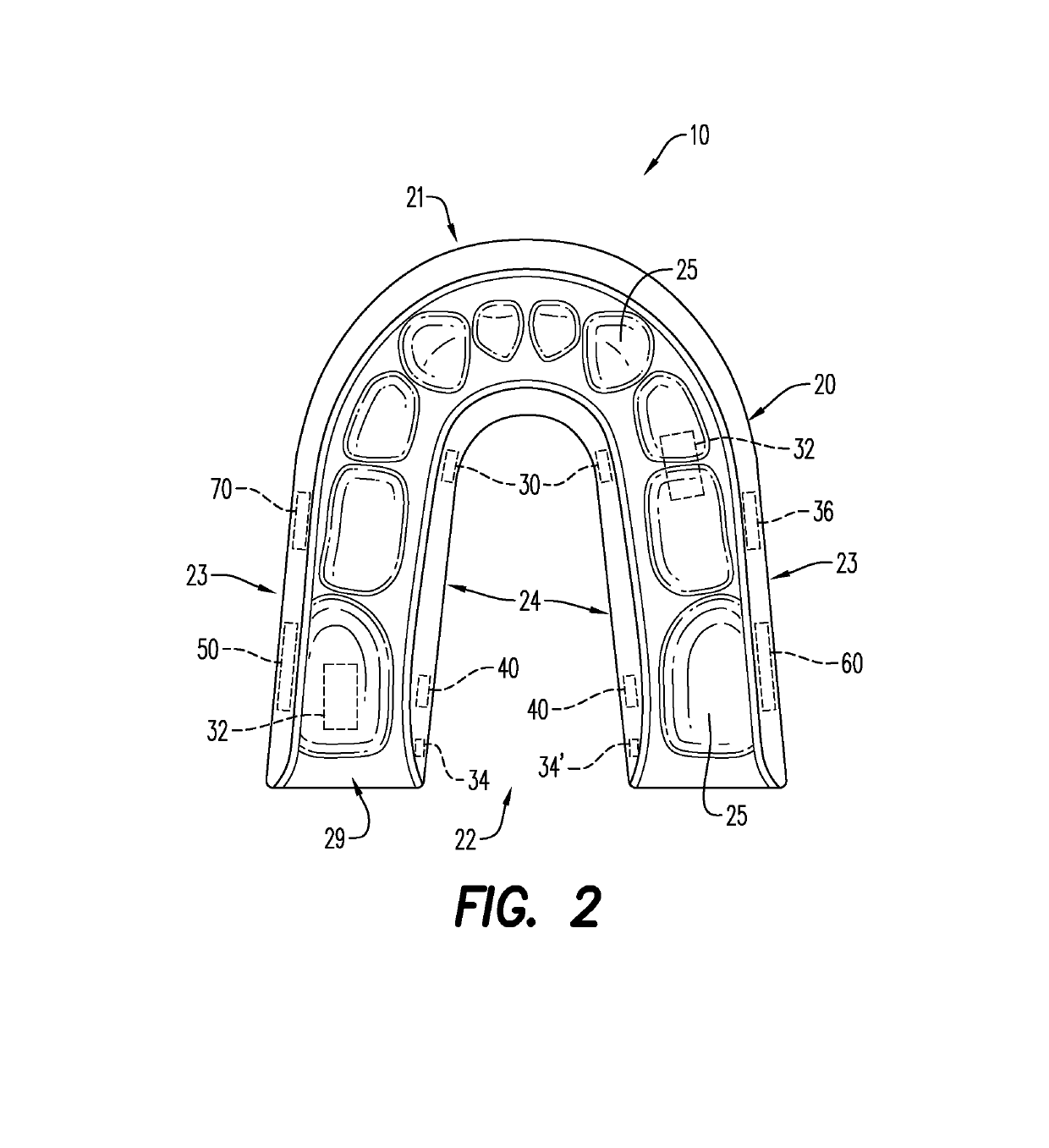 Removable mandibular myo-stimulator