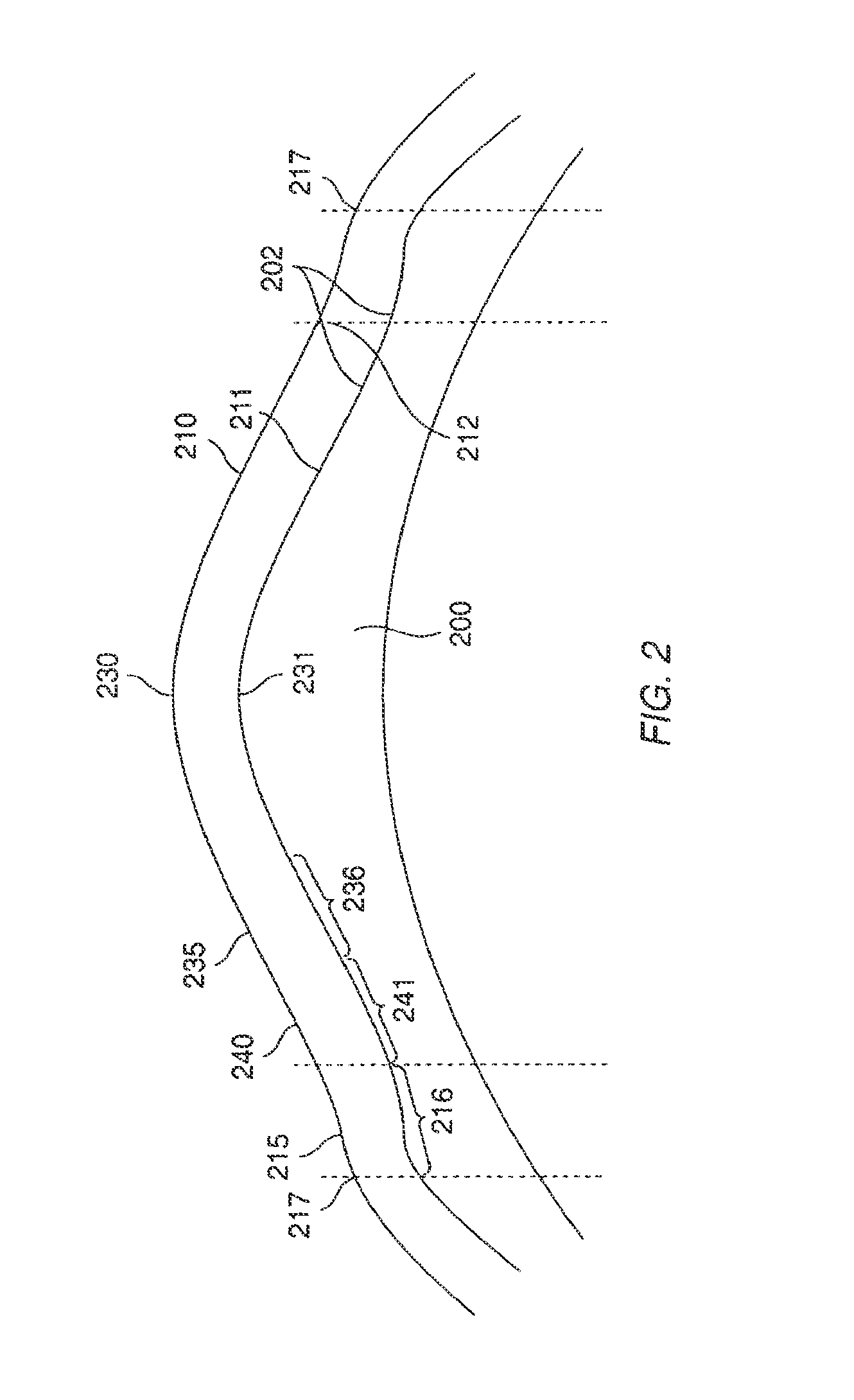 Method and Systems for Laser Treatment of Presbyopia Using Offset Imaging