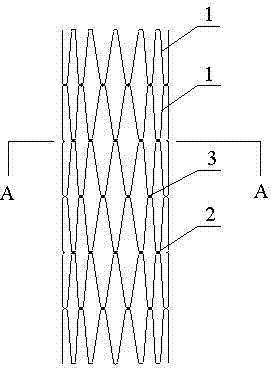 Degradable magnesium alloy esophageal stent for infants