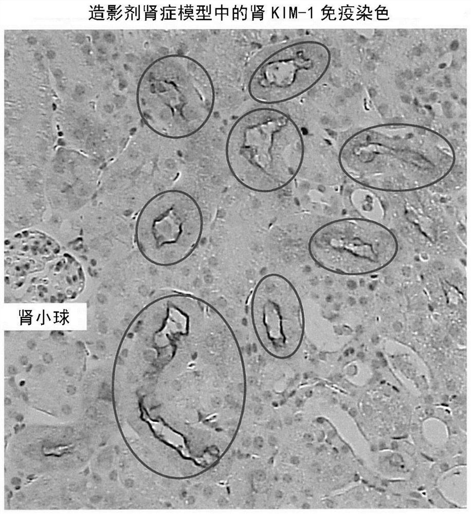 Utilization of cilastatin in inhibiting renal disorder