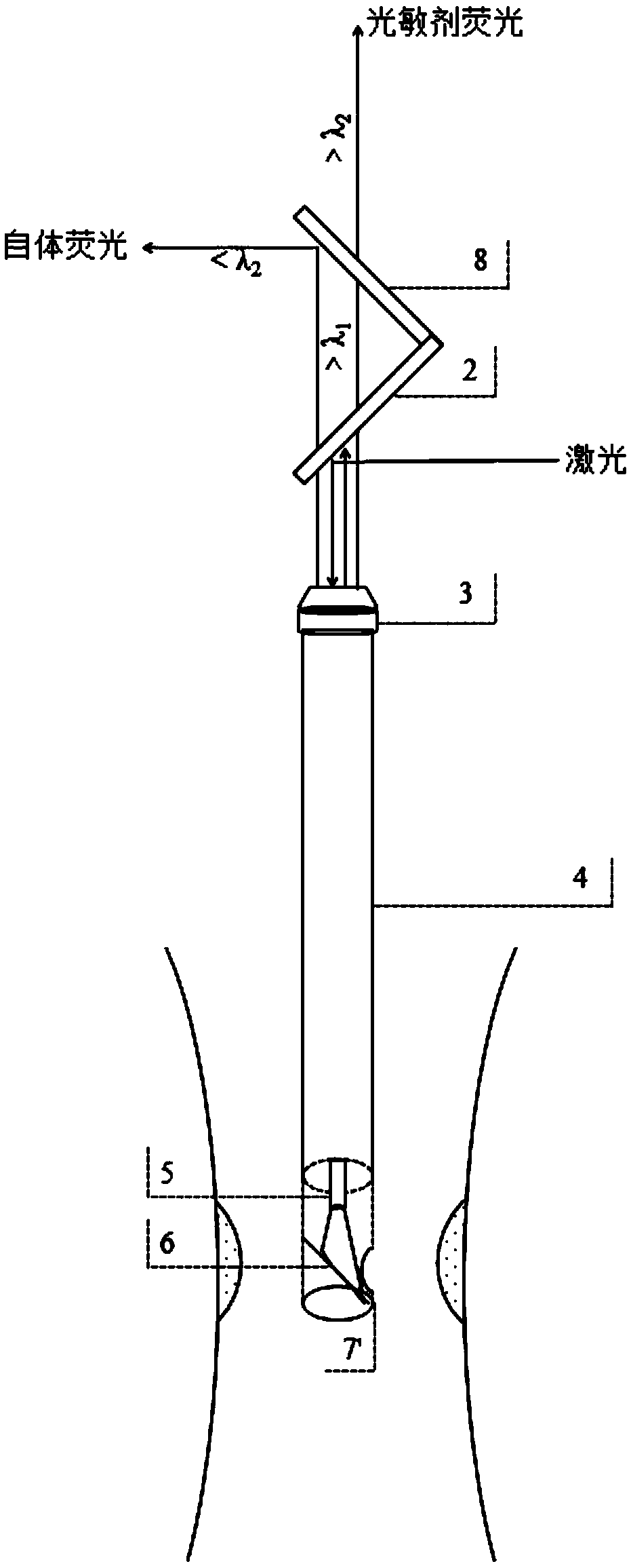 Detection apparatus, system and method for photosensitizer concentration