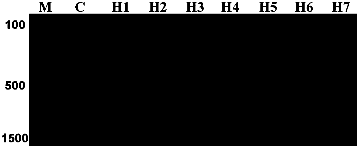 Method for quickly detecting bifidobacterium based on high-throughput sequencing and application