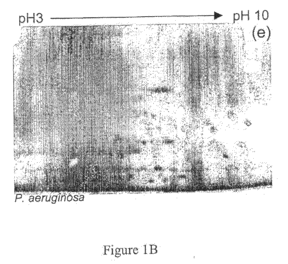 Novel Methods of Diagnosis of Treatment of P. Aeruginosa Infection and Reagents Therefor