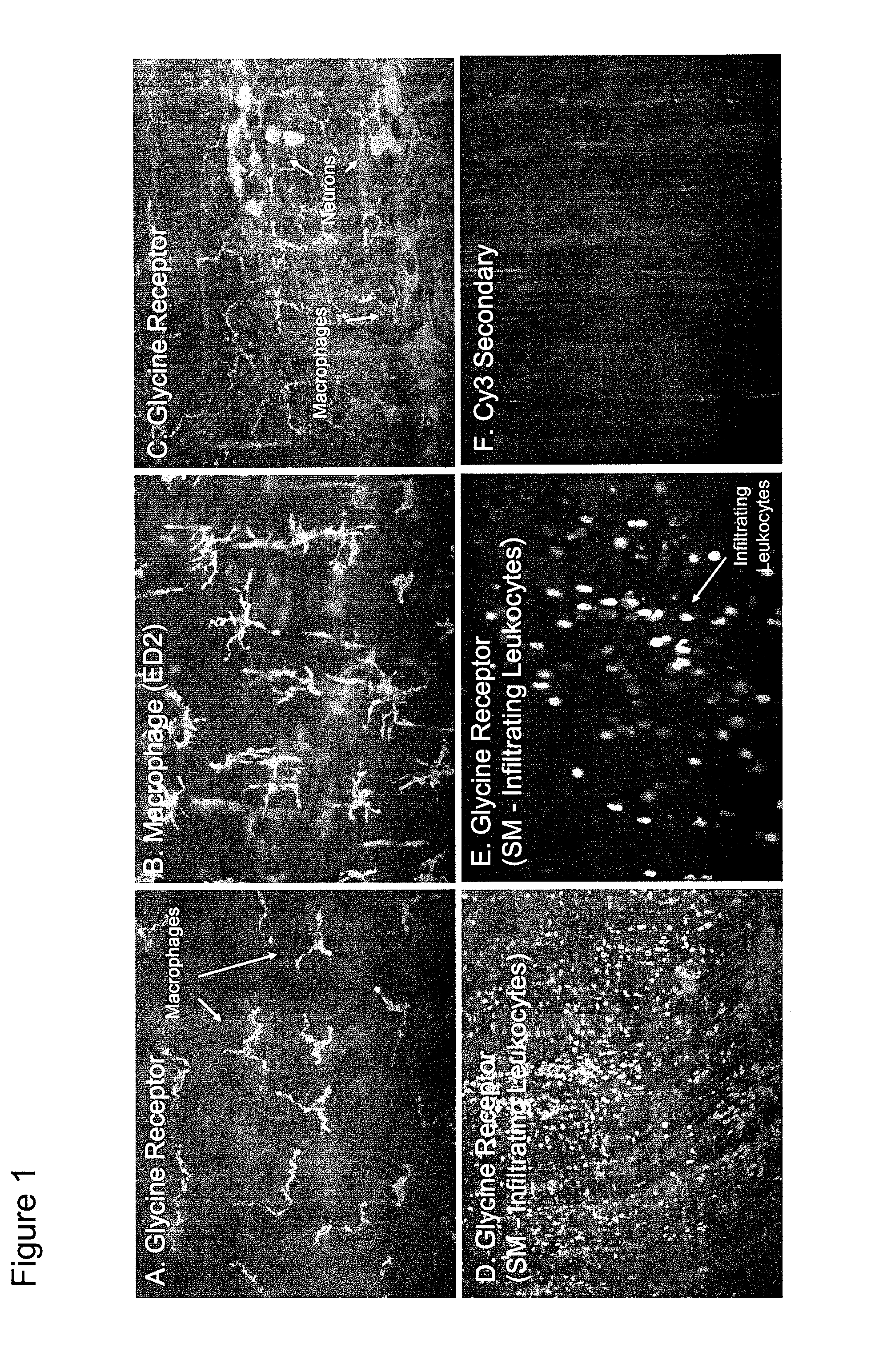 Suppression of postoperative ileus