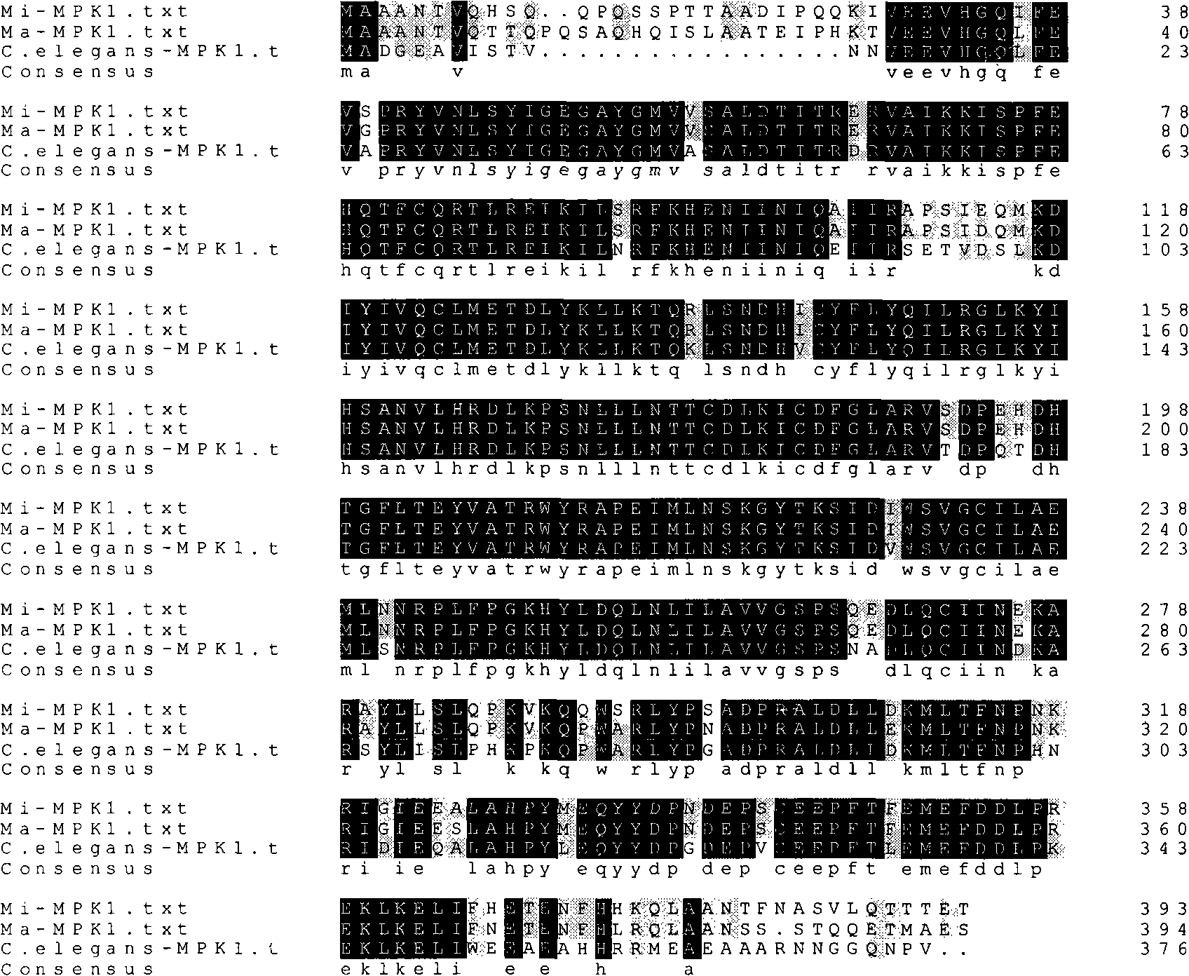 RNA interference vector and use thereof