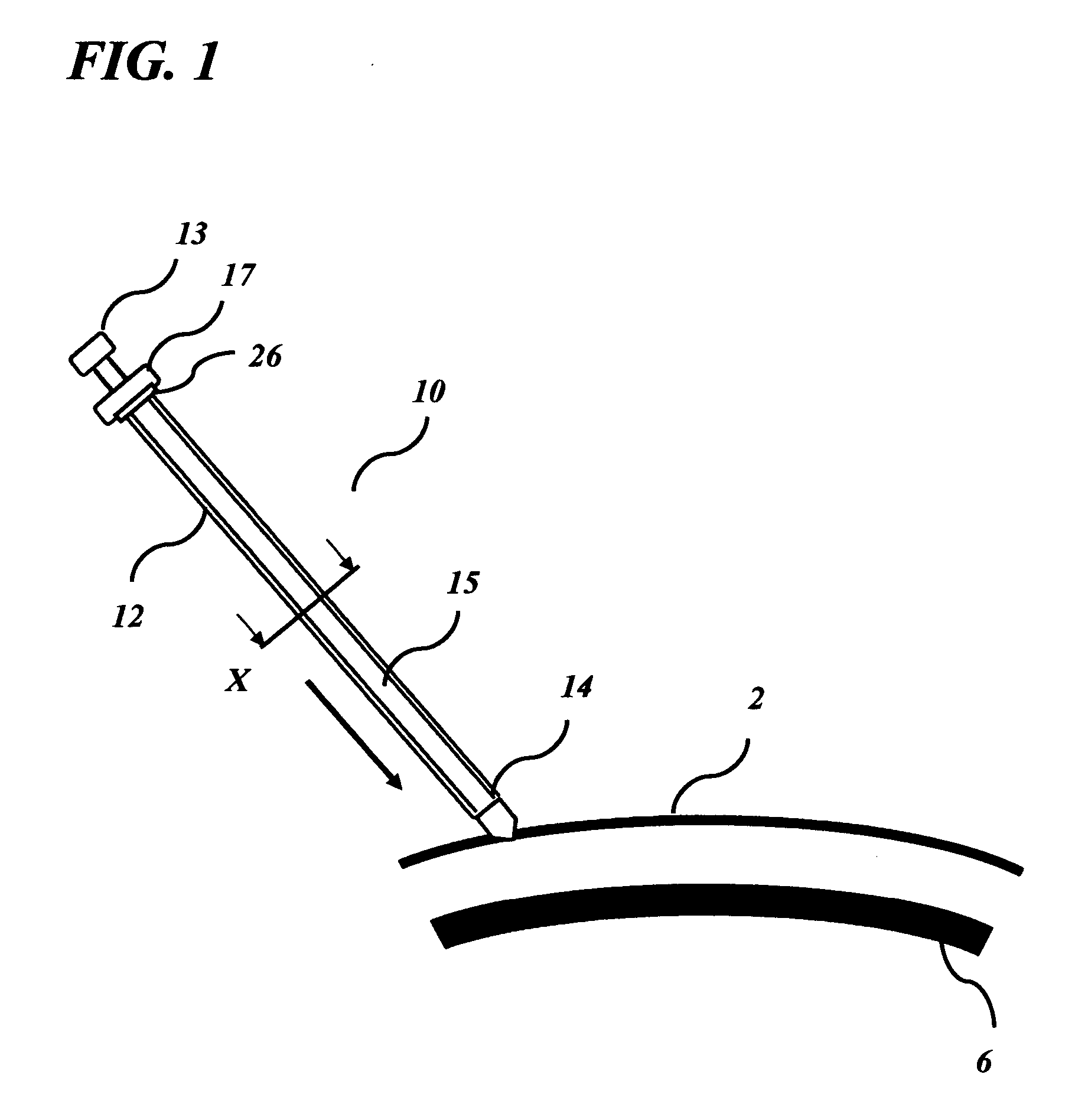 Transverse surgical tunneling