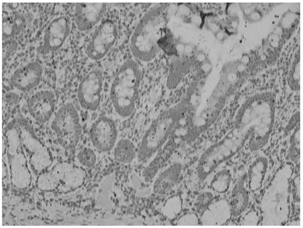 A method for establishing a mouse gastric cancer model