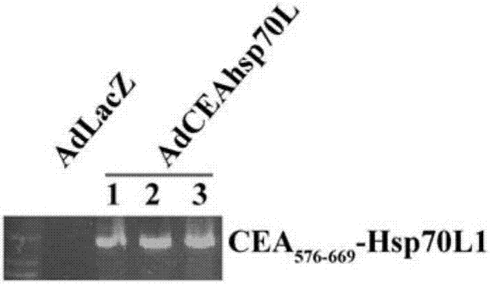 Fusion protein gene-carried recombinant adenovirus and preparation method and applications thereof