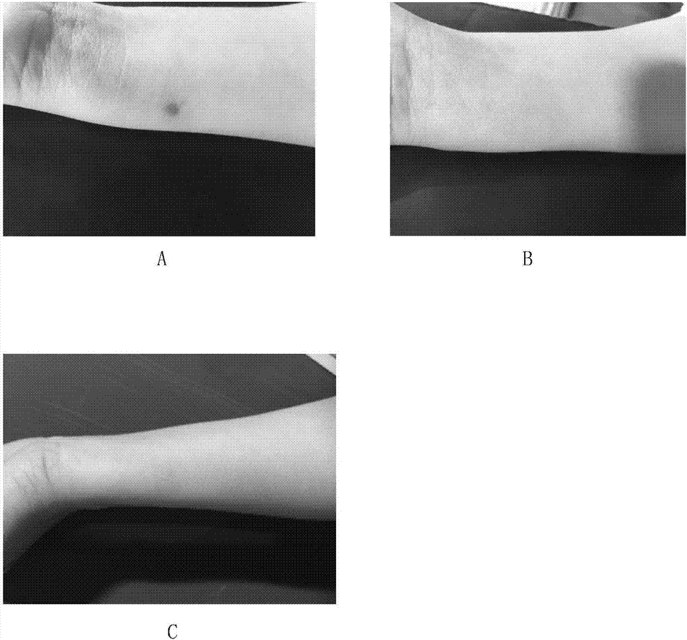 Silica gel with concealing and scar treating functions and preparation method