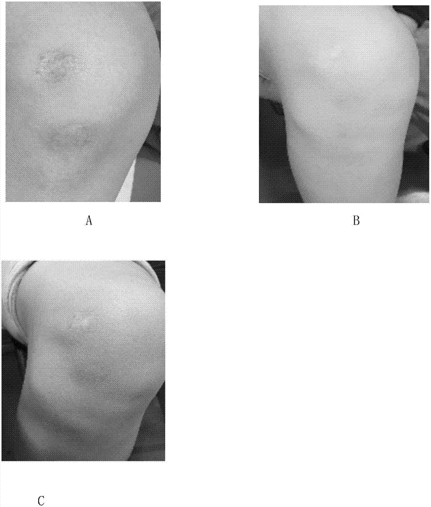 Silica gel with concealing and scar treating functions and preparation method