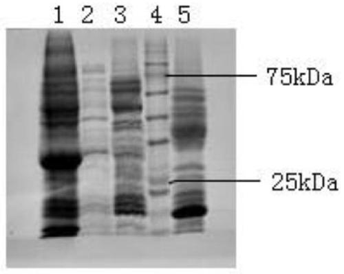 Method for extracting beta-conglutin from Australian sweet lupin meal