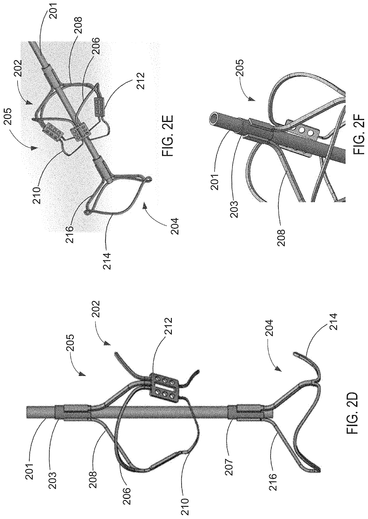 Apparatus and methods for treating a defective cardiac valve