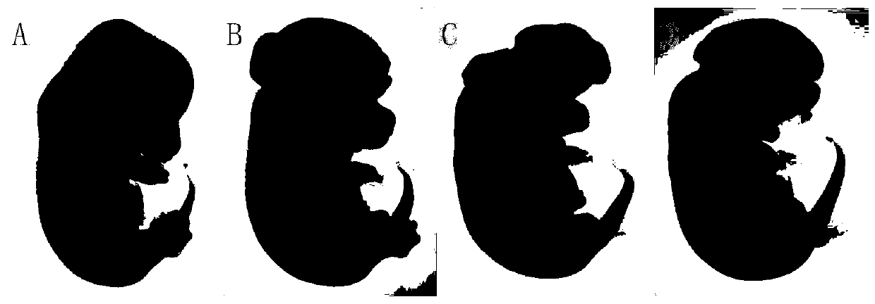 Application of DNA methyltransferase inhibitor to construction of neural tube defect mouse model