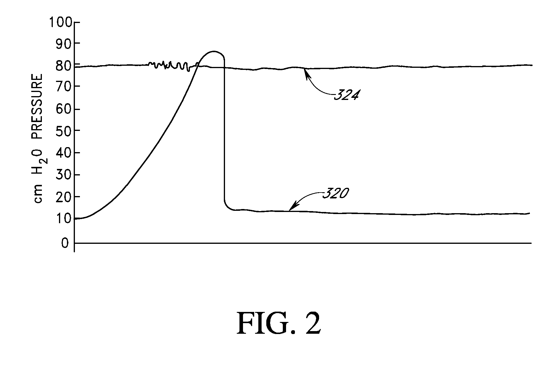 Implant with high vapor pressure medium