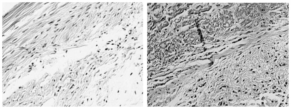 Tendon repair material, preparation method and application in preparation of tendon repair product