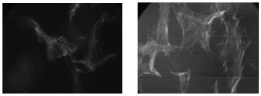 Tendon repair material, preparation method and application in preparation of tendon repair product