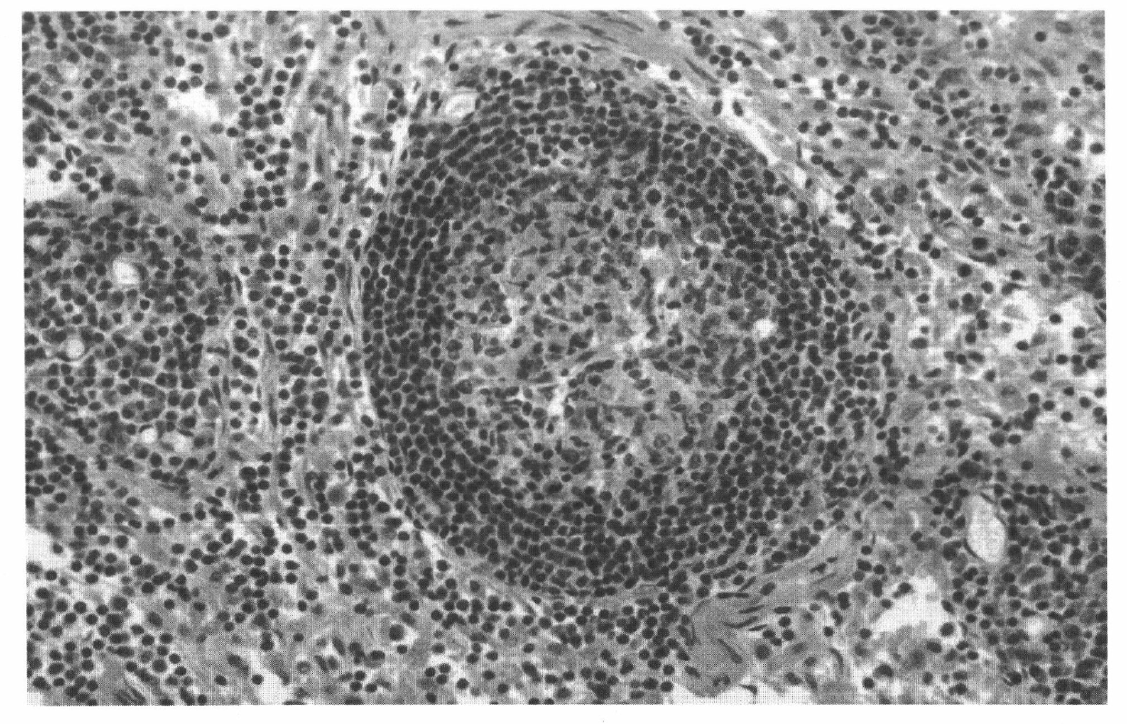 Mercury-free environment-friendly hematoxylin staining solution