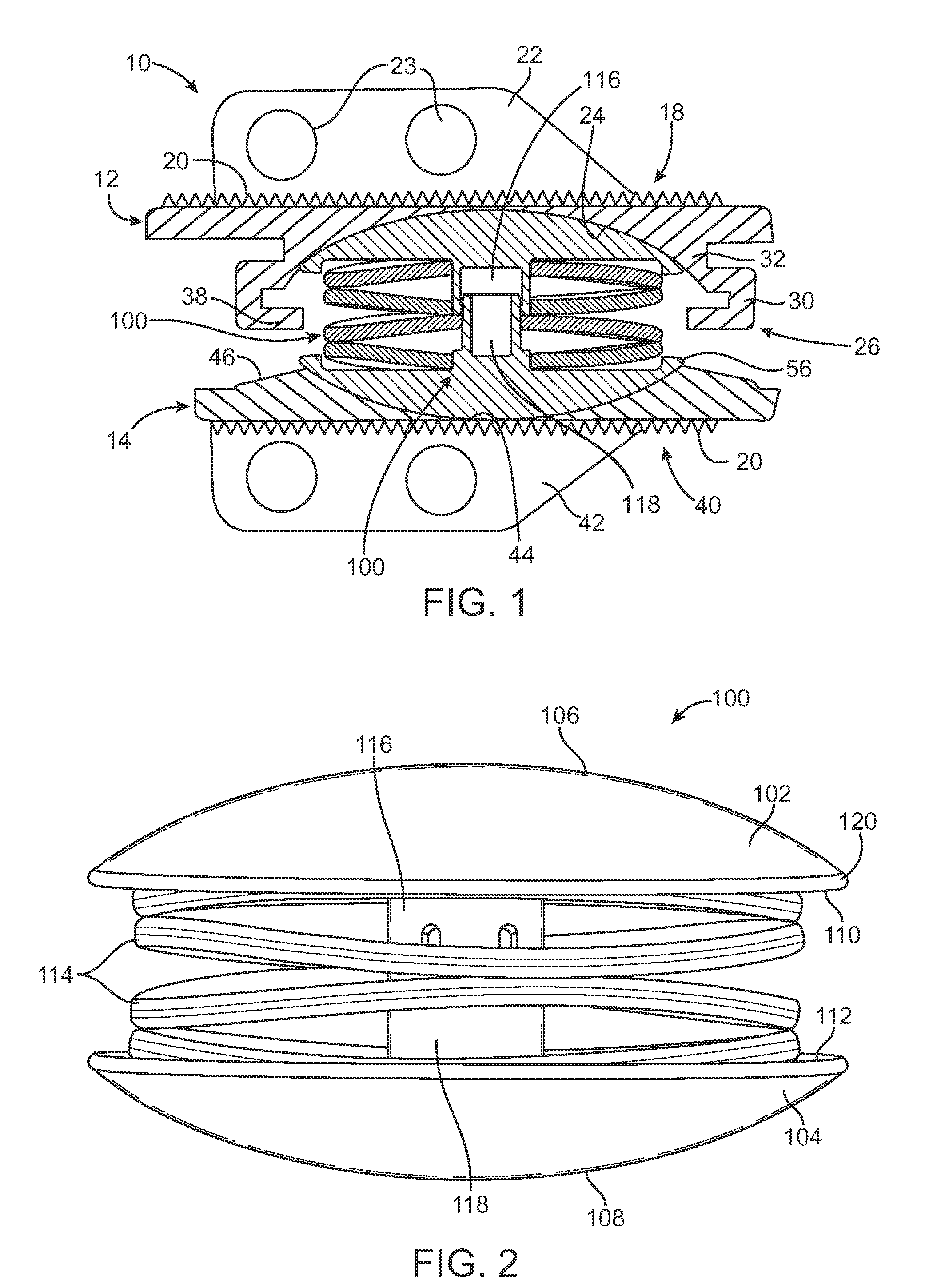 Compliant Implantable Prosthetic Joint With Preloaded Spring