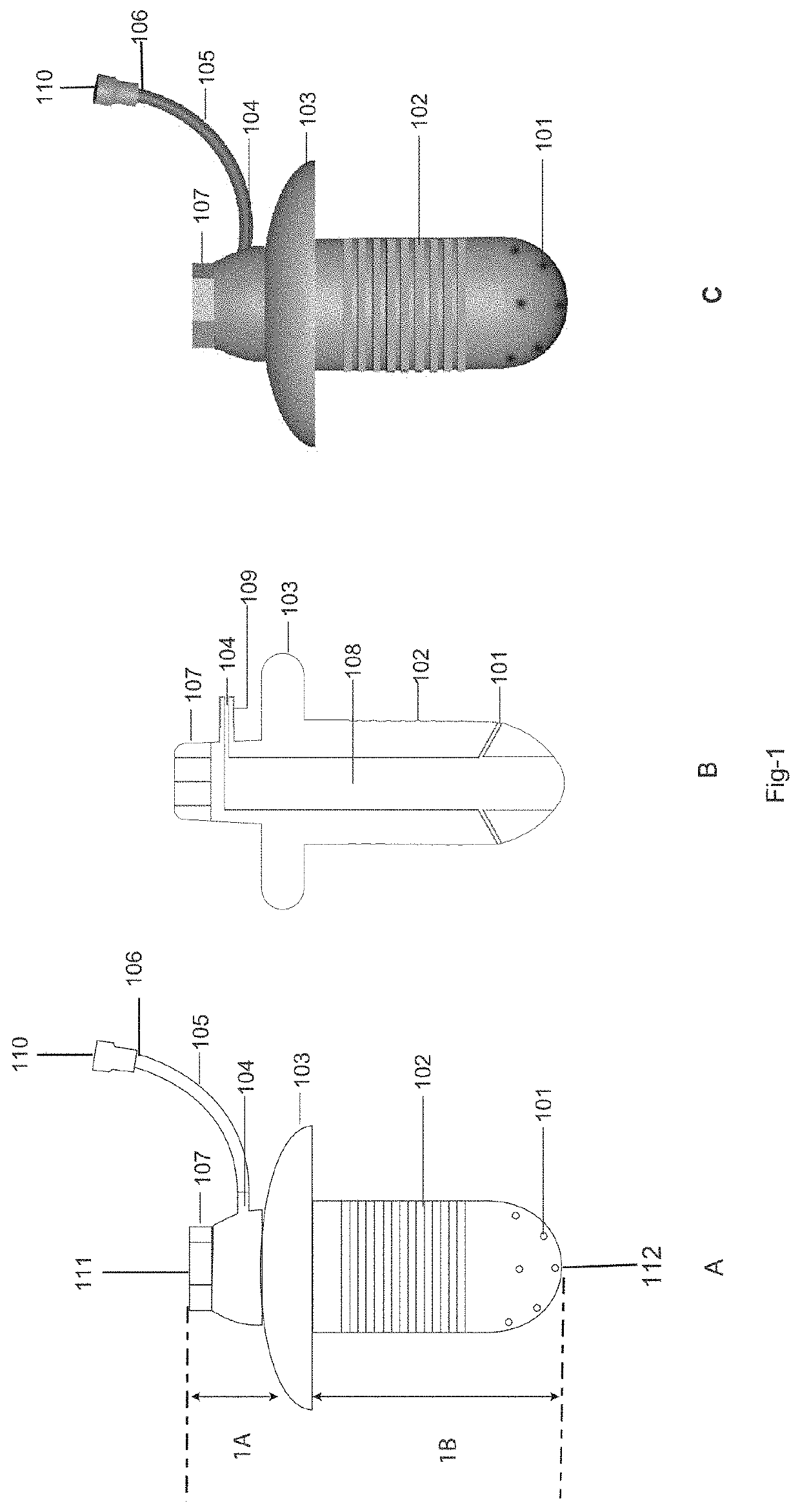 Drug delivery system and method for controlled and continuous delivery of drugs into the brain by bypassing the blood brain barrier.