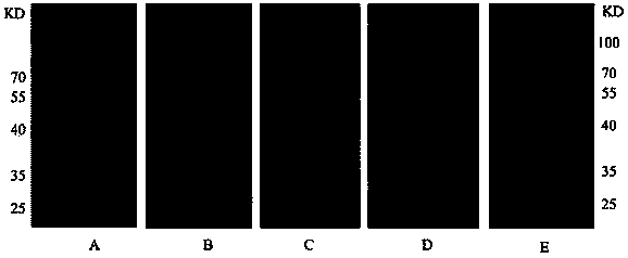 Epitope vaccine for resisting subgroup J avian leukosis virus infection as well as preparation method and application of epitope vaccine