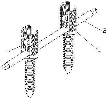 Pelvic internal fixation unit and application thereof