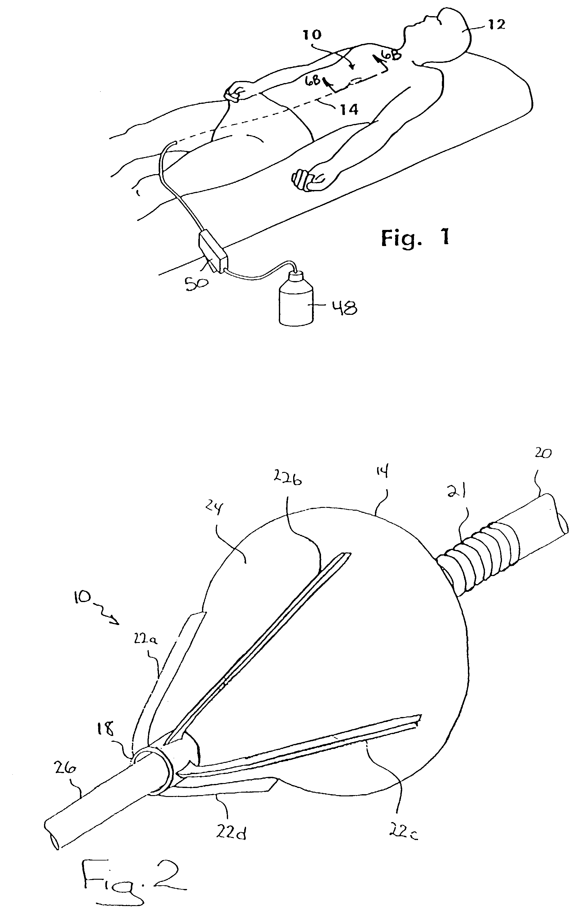 Reciprocating cutting and dilating balloon