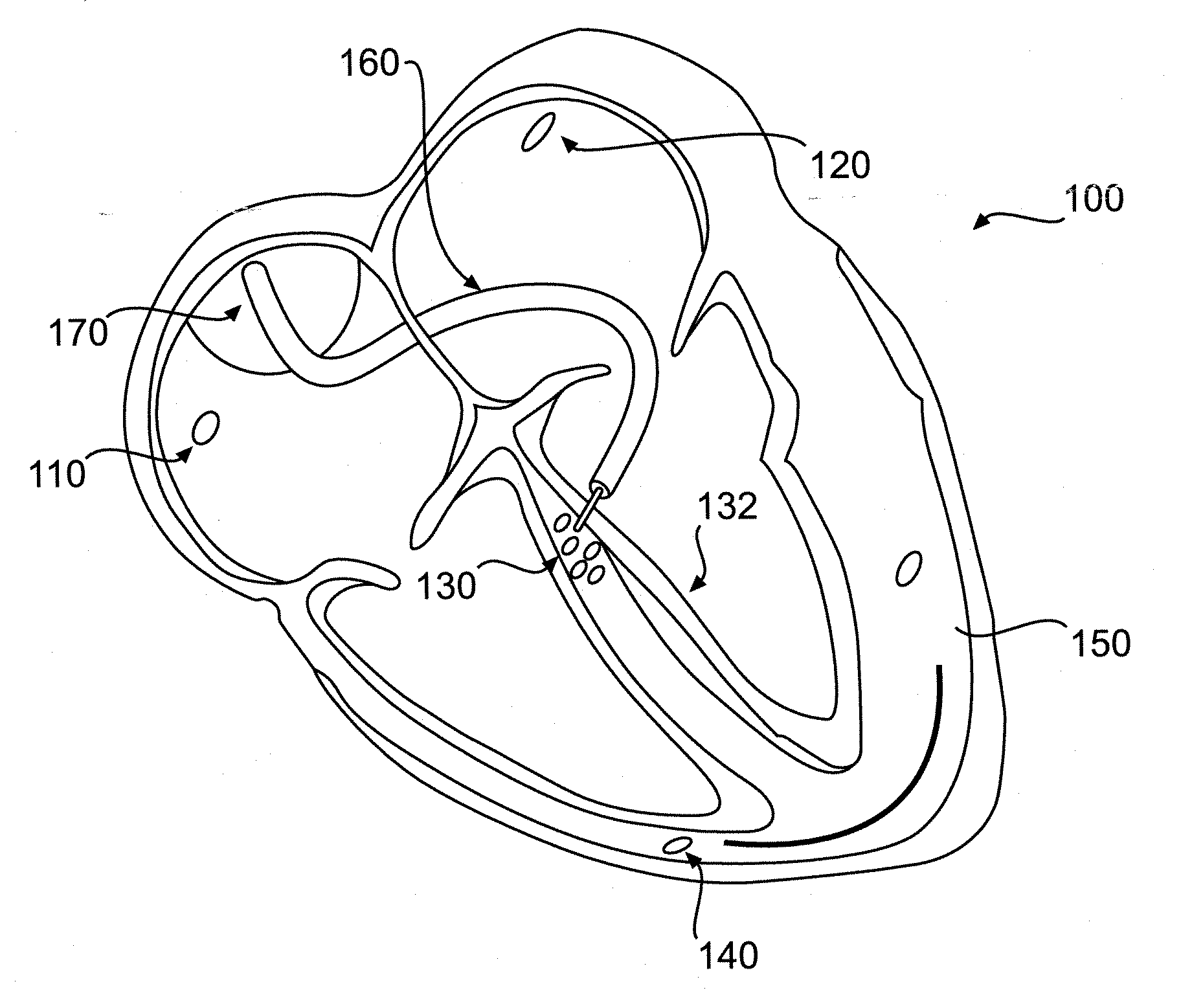 System And Method For Determining The Origin Of A Sensed Beat