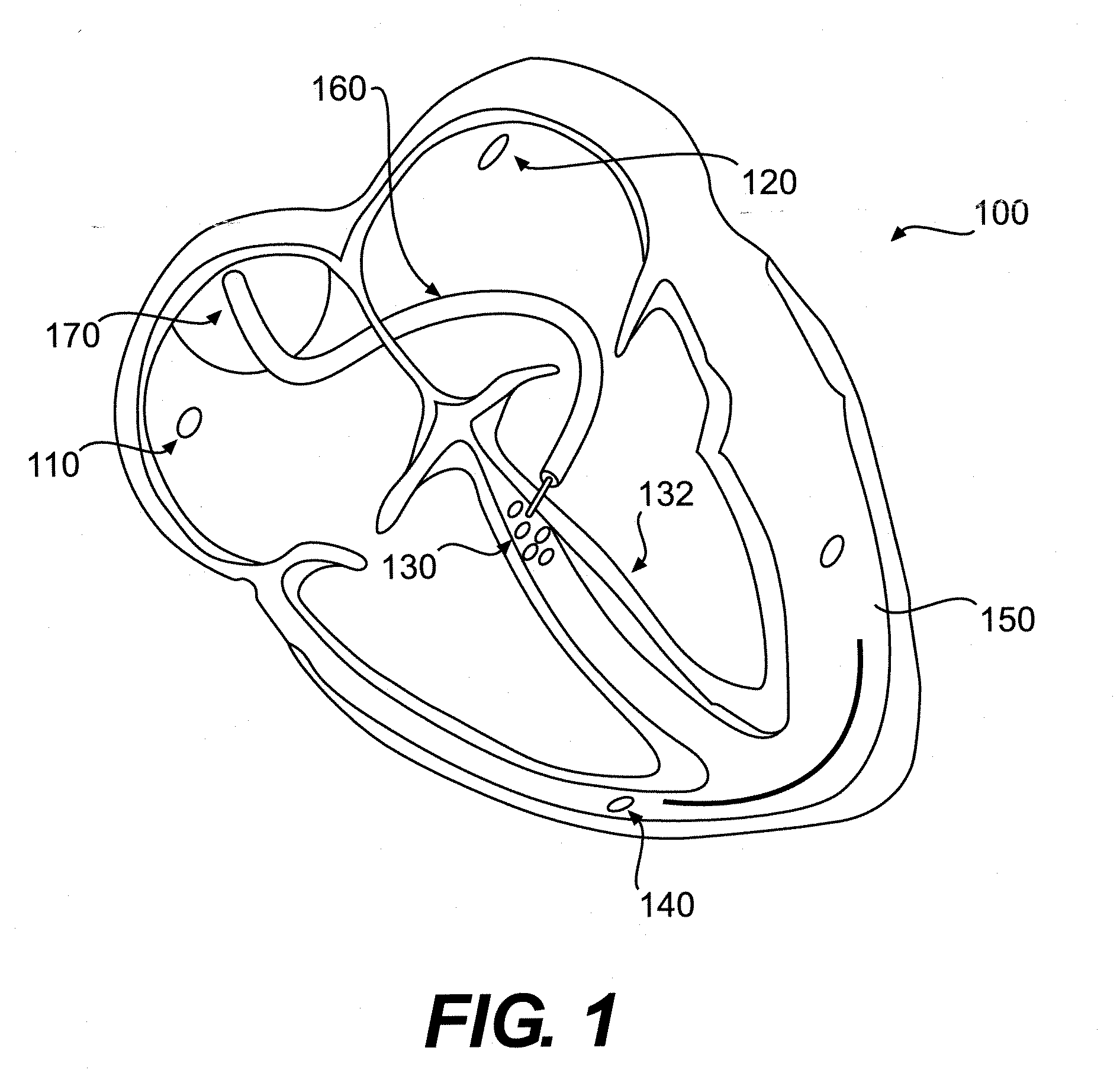 System And Method For Determining The Origin Of A Sensed Beat